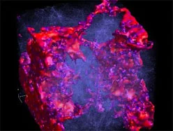 Exploring the epoch of reionization through the 21 cm radiation
