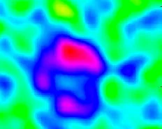 Discovery of an Extremely Bright Sub-Millimeter Galaxy at z=3.93