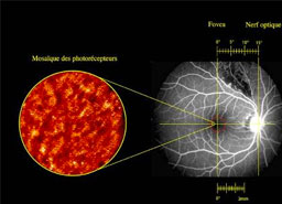 The project « Oeil »: astronomy enters hospital